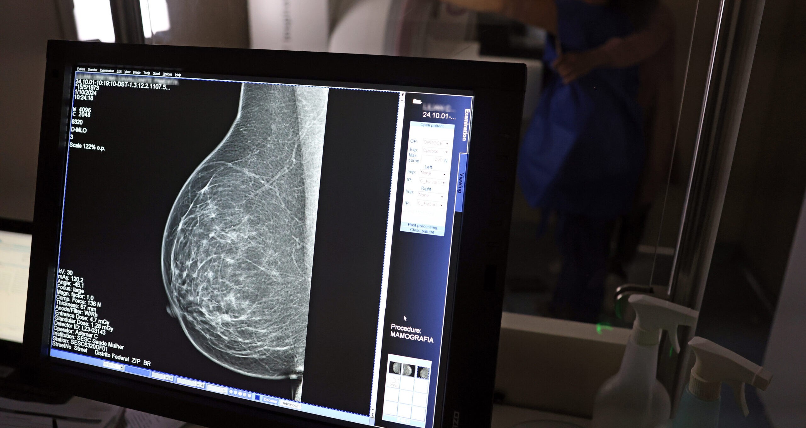 Caminhões da Mamografia farão mais de 5 mil exames em janeiro; veja o cronograma