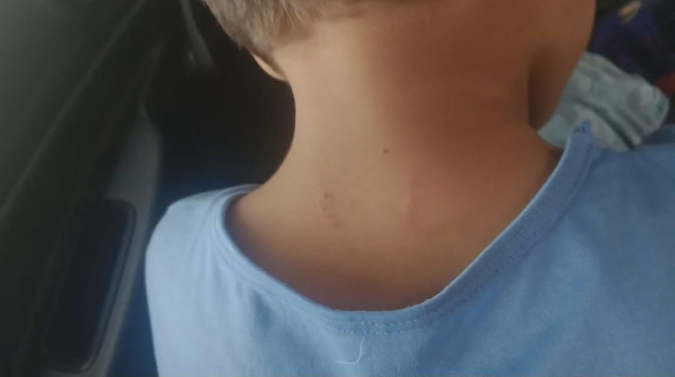 Criança apareceu com arranhão em casa e disse que foi colega de turma — Foto: Reprodução