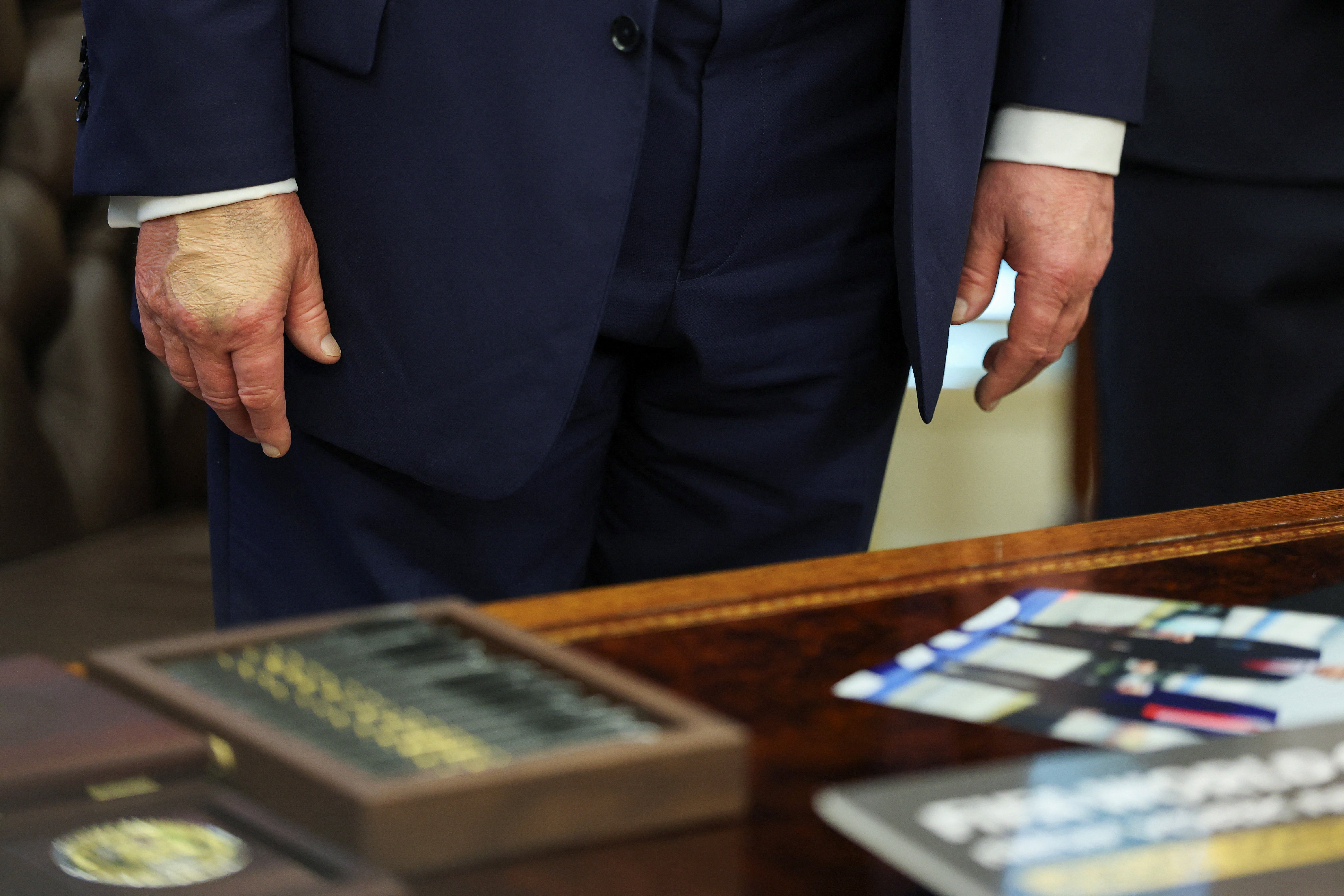Trump volta a aparecer em público usando maquiagem na mão, um mês depois de diagnóstico de insuficiência venosa crônica