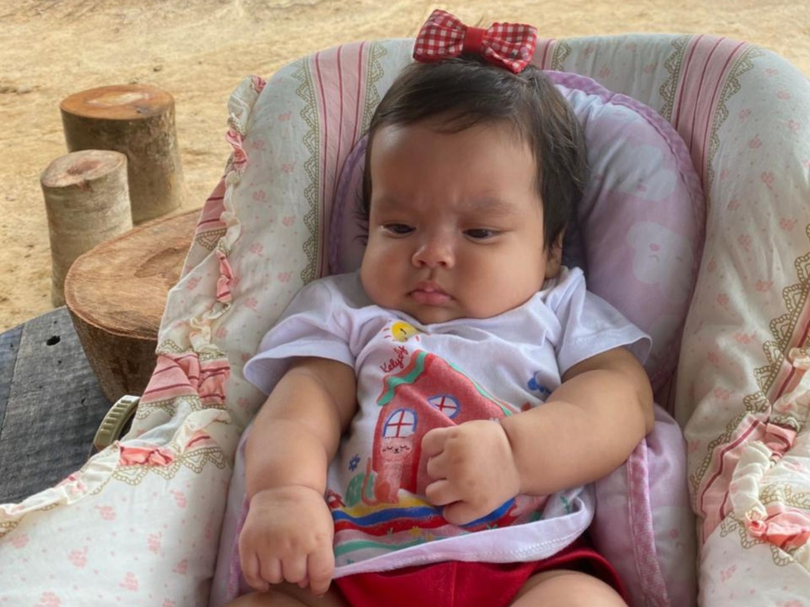 Bebê de 3 meses é diagnosticada com tumor no cérebro após ir a hospital com gripe no AC: ‘Abalados’