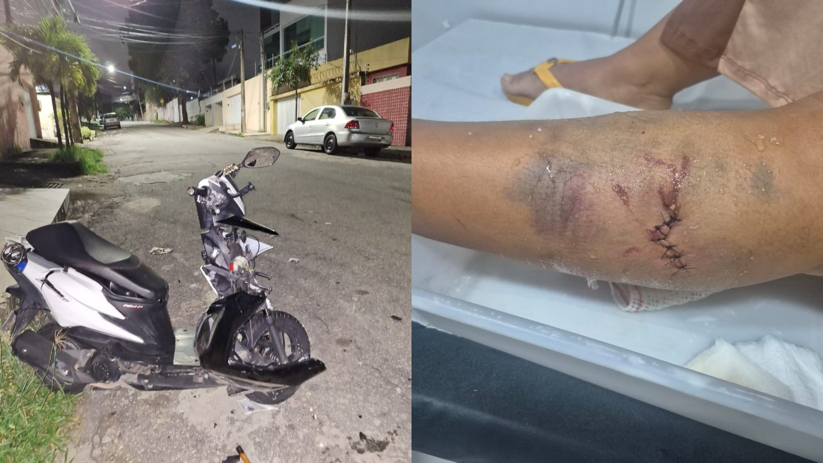 Mulher denuncia agressão e atropelamento cometidos por companheiro músico em Fortaleza