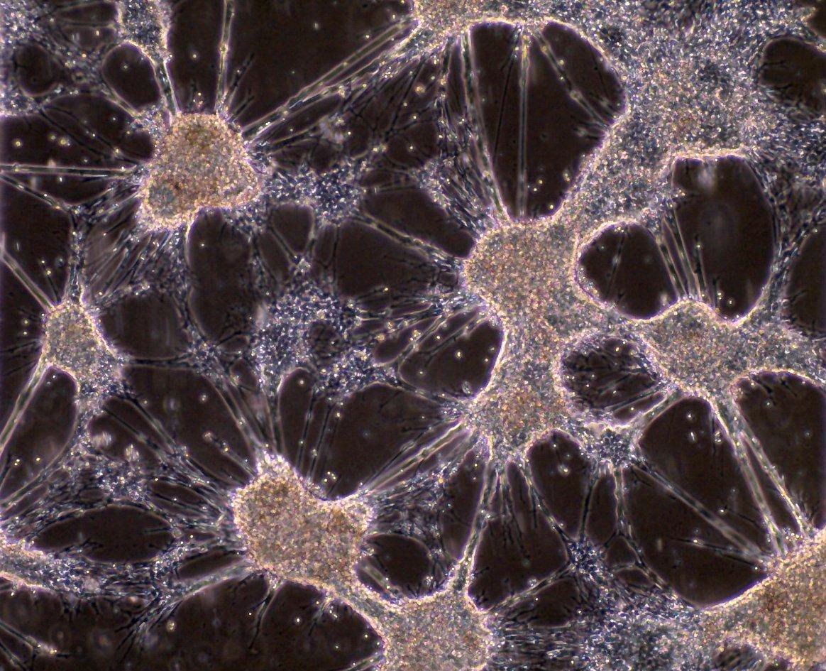 Como as células-tronco podem ajudar na recuperação do cérebro após um derrame