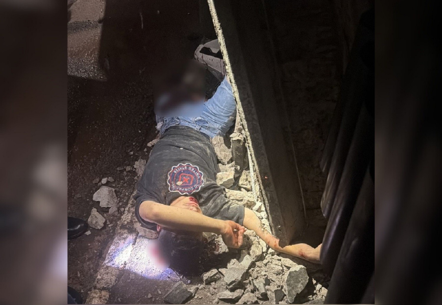 Adolescente fratura as duas pernas e tem braço esmagado após ser atropelado por viatura da PM no Tocantins