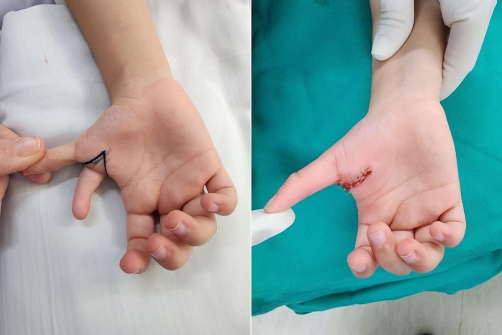 Cirurgia foi realizada com duas médicas especialistas — Foto: Divulgação/Casa de Saúde de Guarujá