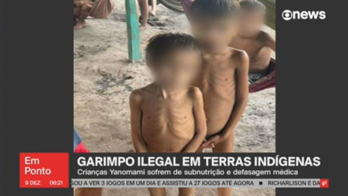 Crianças indígenas estão sofrendo de subnutrição em comunidade invadida por  garimpeiros ilegais em Roraima