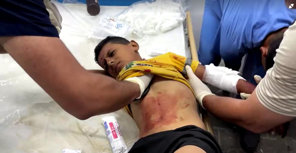 Criança fica ferida após ataque de Israel em Rafah, ao sul de Gaza, neste domingo (26) — Foto: Reuters