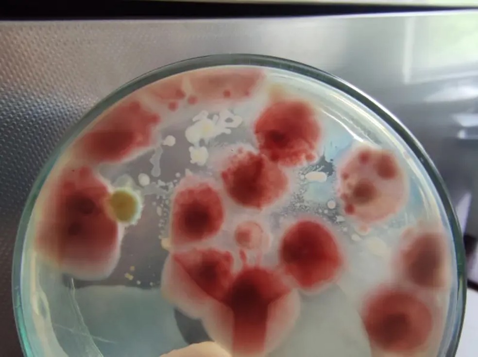 A estrutura genômica do Fusarium oxysporum permite que ele tenha uma ampla gama de hospedeiros, como tomates, pepinos e melancias — Foto: Getty Images