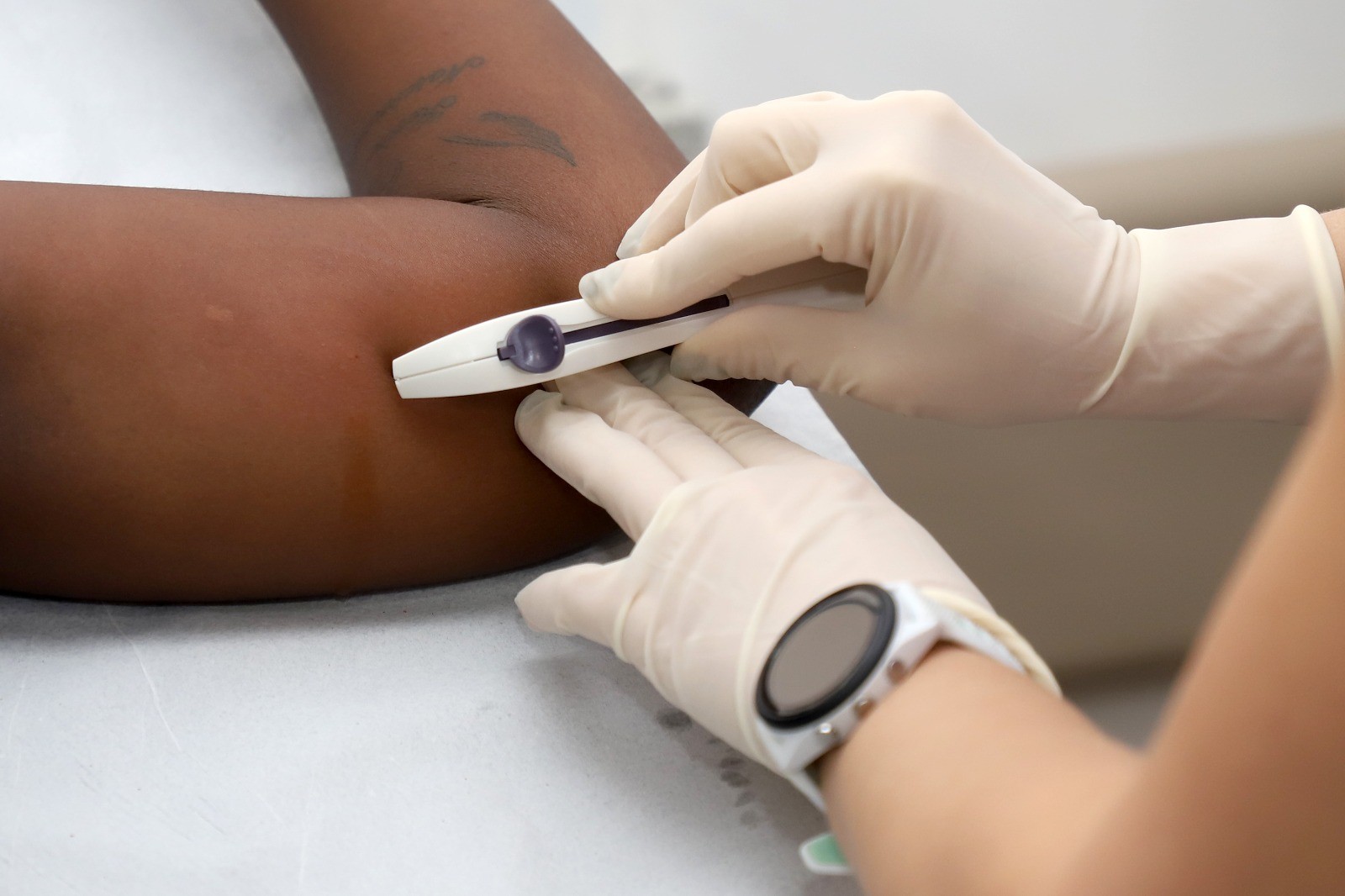 Implantes anticoncepcionais: uso cresce 553% em Campinas após ampliação do acesso na rede pública
