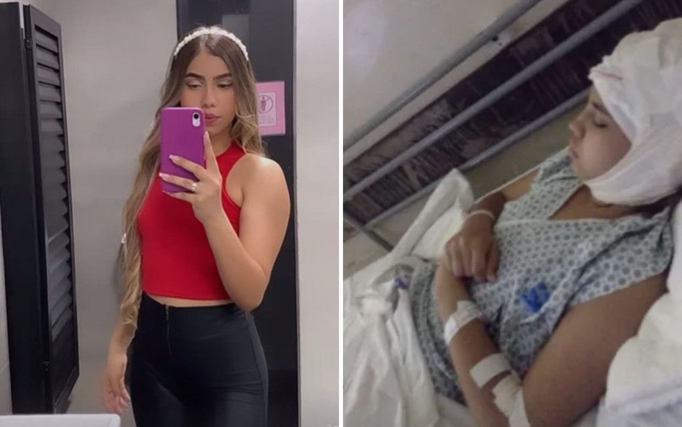 Fotos mostram a adolescente Heloísa Heliodoro, de 17 anos, antes e depois do acidente com kart — Foto: Reprodução/Redes Sociais e Arquivo pessoal