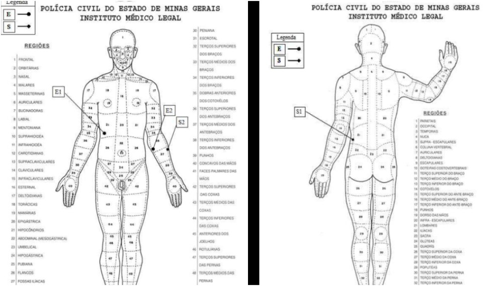 Laudo da Polícia Civil aponta onde o gari foi atingido. — Foto: Reprodução