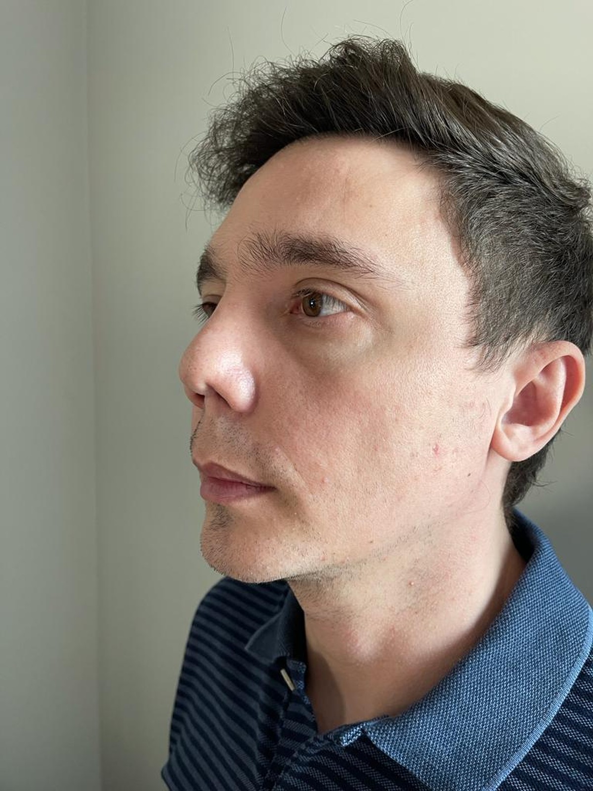 Polícia e Cremesp investigam cirurgião plástico suspeito de deformar 