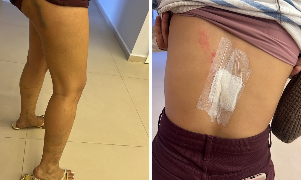 ‘Eu abracei meu noivo e disse que iríamos morrer’, relata sobrevivente de acidente com ônibus em Petrópolis