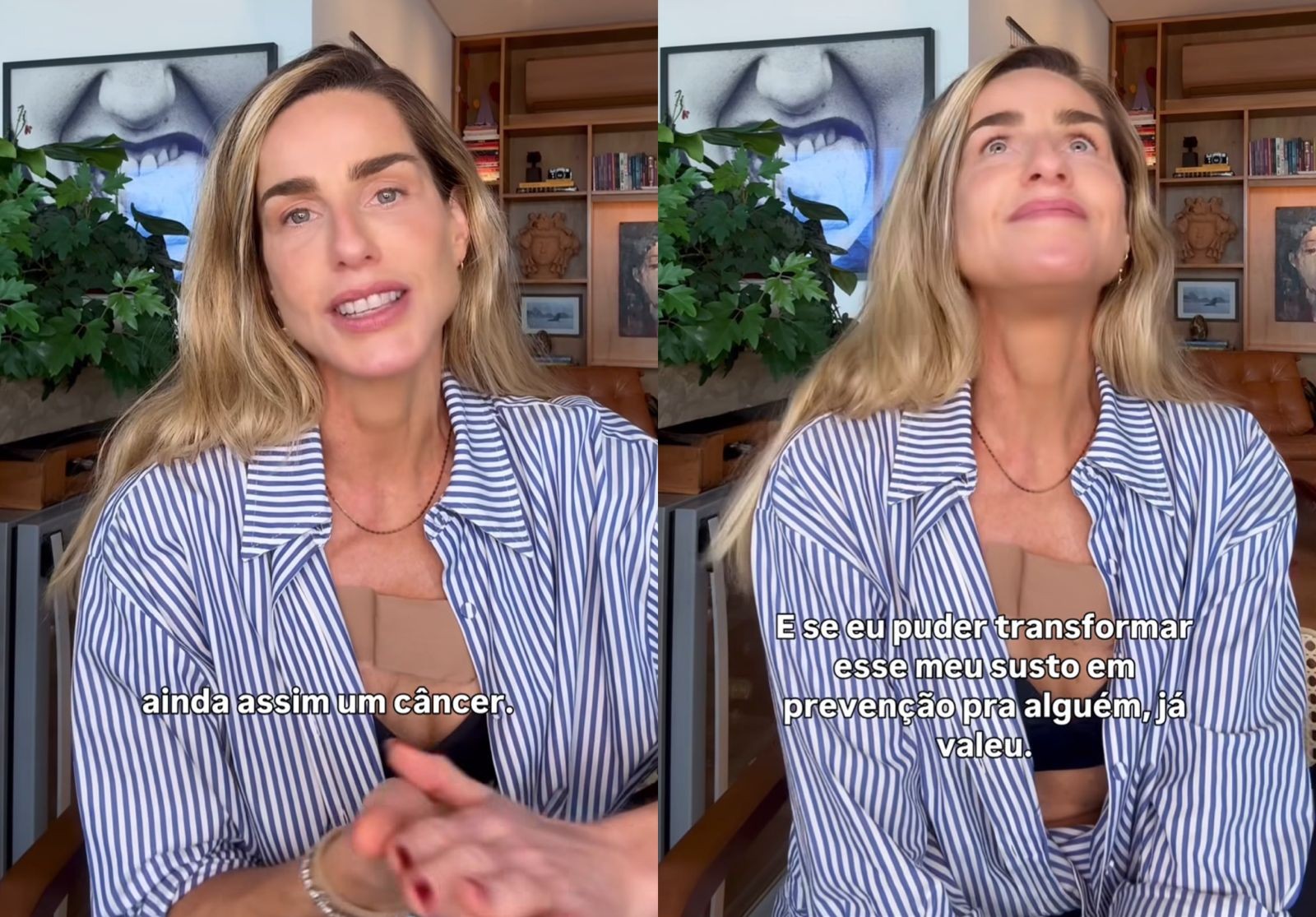 Modelo Mariana Weickert anuncia diagnóstico de câncer de pele e faz alerta: 'Poderia ter sido evitado'