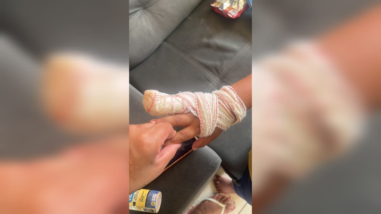 Criança de 4 anos precisa amputar parte do dedo ao prender mão em porta de creche em Sorocaba