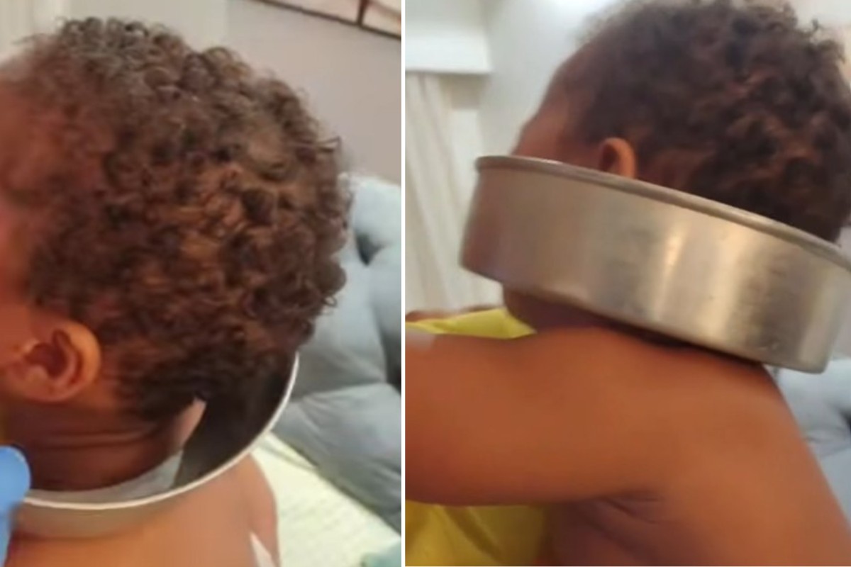 Bebê de 1 ano é resgatado com a cabeça presa em forma de bolo no litoral de SP; VÍDEO