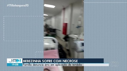 Bebê sofre necrose após aplicação de remédio em hospital de Palmas