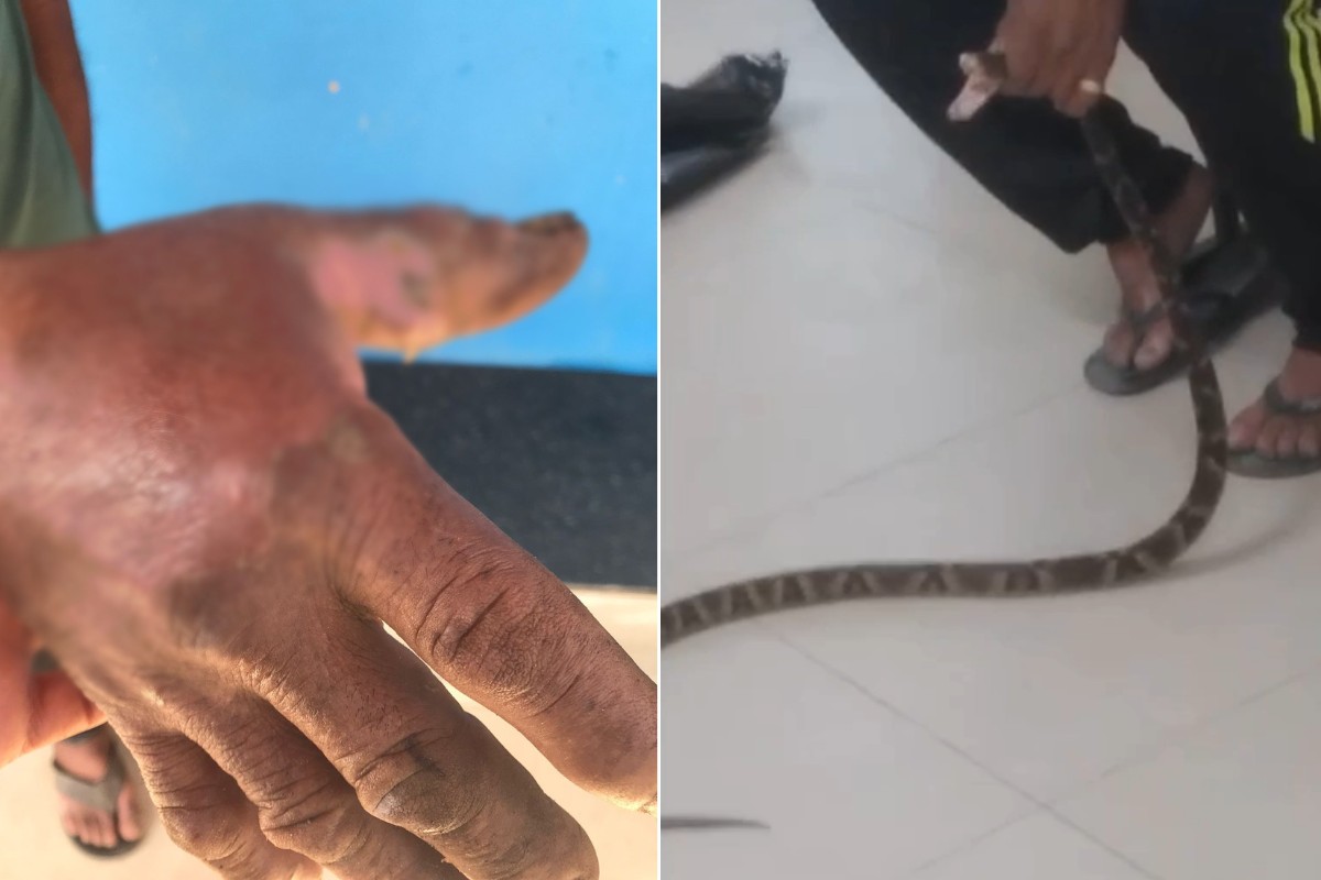 Homem que levou cobra à UPA após ser mordido diz já ter capturado mais de 350 serpentes