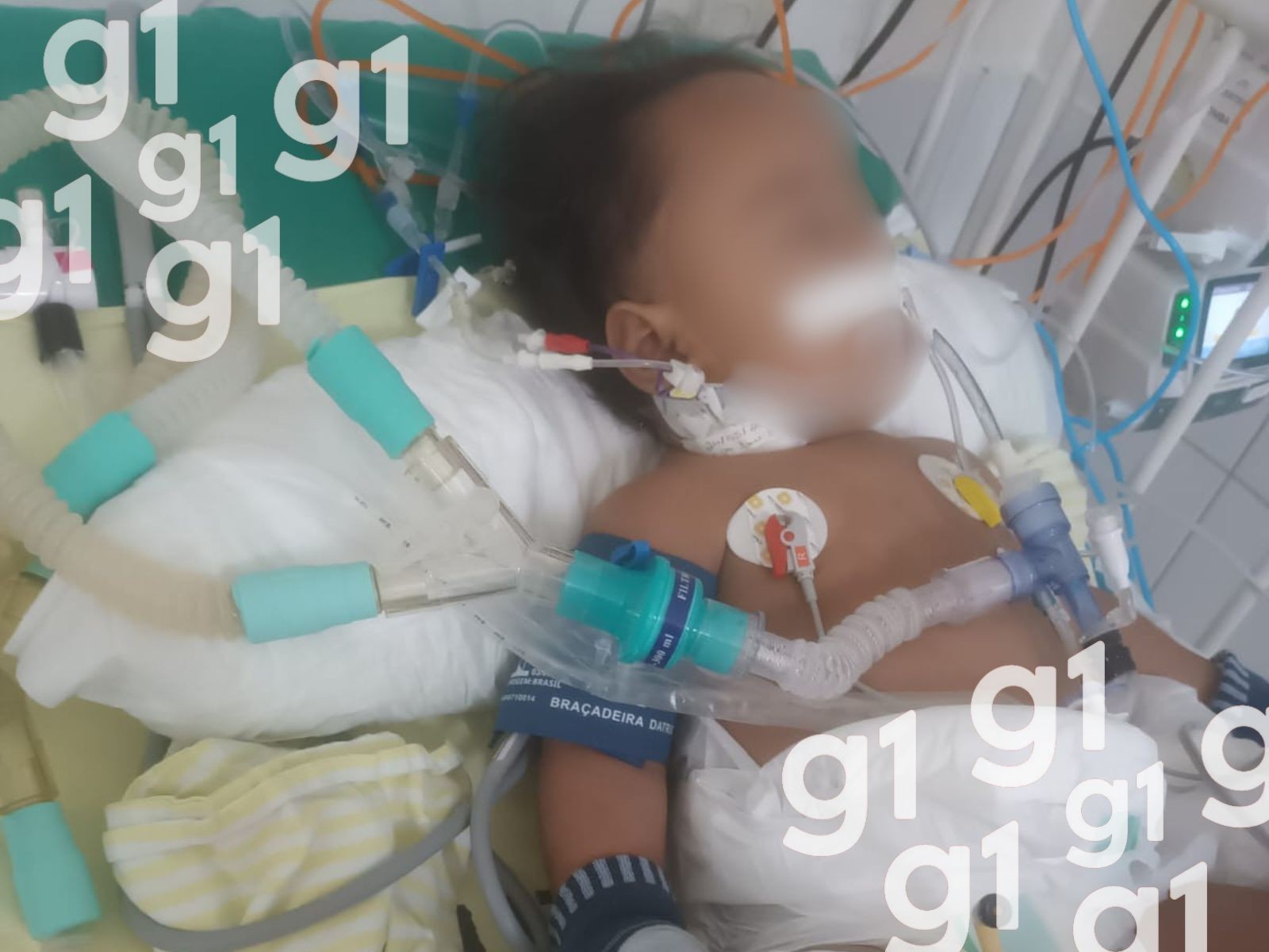 Família de bebê de 1 ano com crises convulsivas luta por diagnóstico no Acre: 'Morrendo a cada dia'