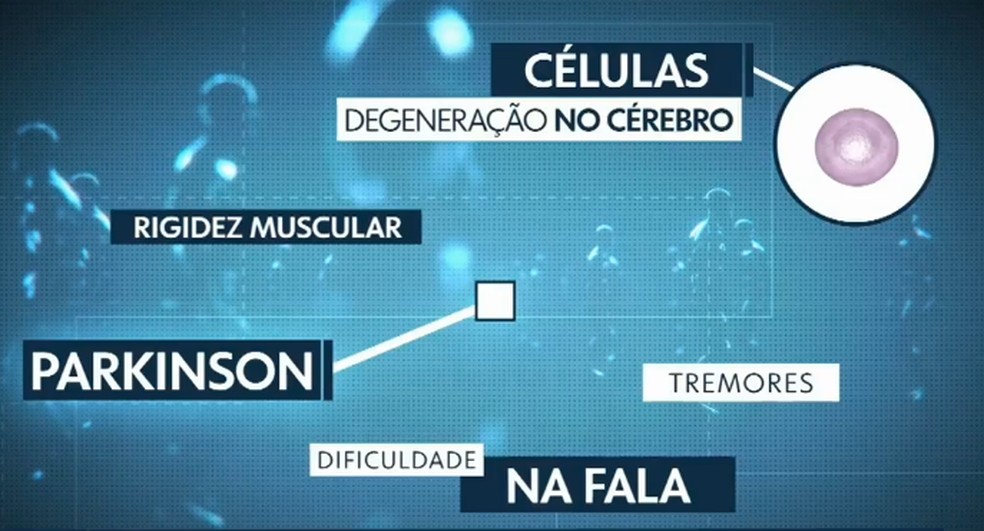 Parkinson afeta a produção de dopamina — Foto: Artes/RPC Curitiba