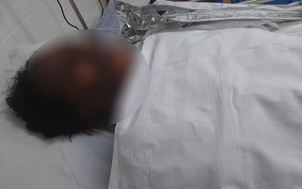 Mulher incendiada durante discussão em Salvador está internada no HGE — Foto: Arquivo Pessoal