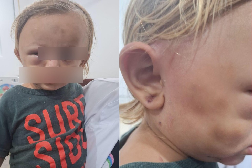 Criança de 1 ano é levada ao hospital após ser espancada por padrasto em Cuiabá — Foto: Reprodução