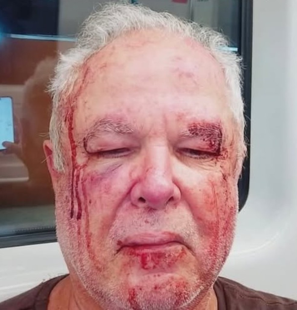Polícia Civil investiga agressão ao idoso Mauro Figueiredo Rocha Dias da Costa, em Copacabana — Foto: Reprodução