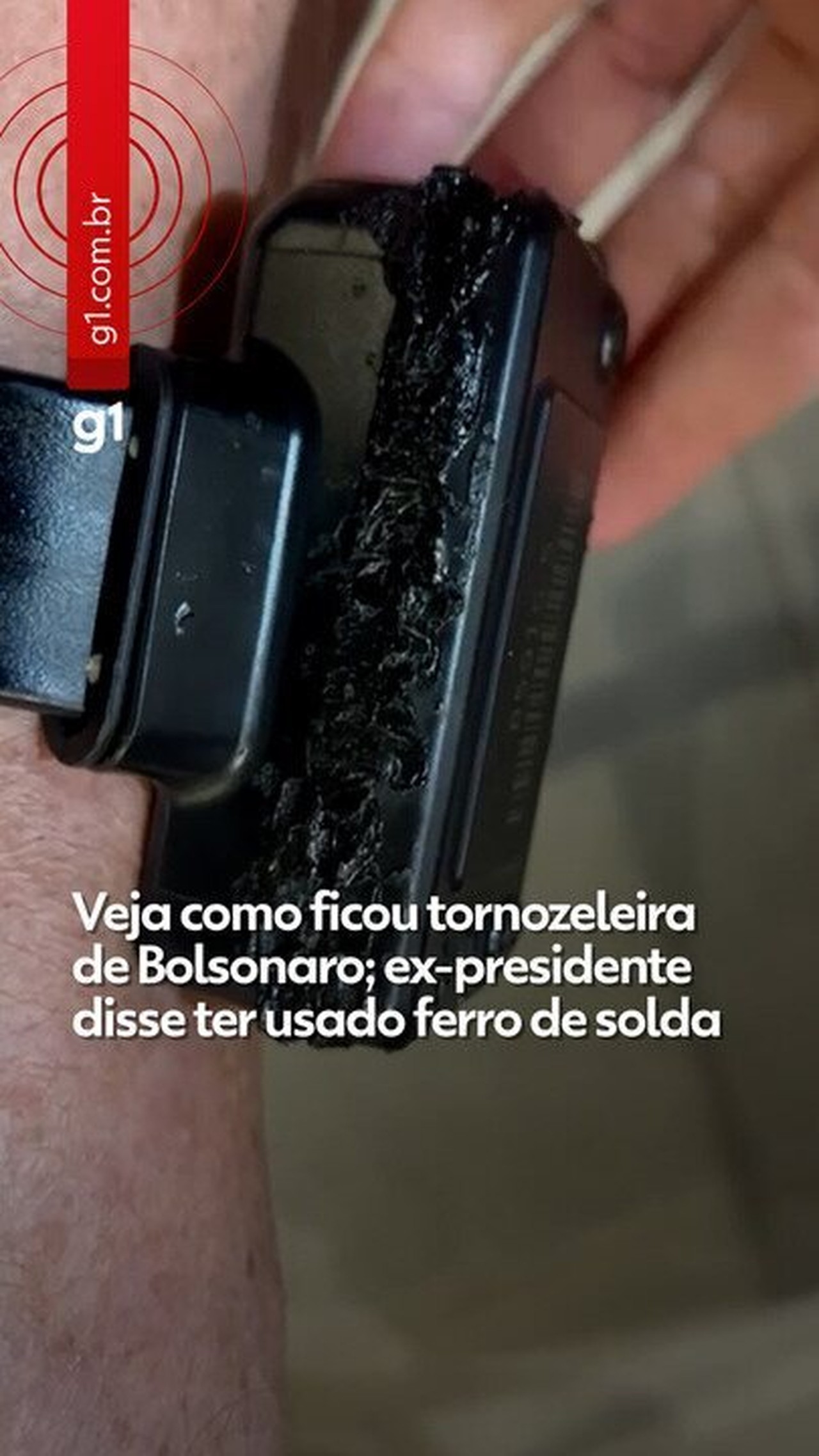 Antes de admitir ter usado ferro quente, Bolsonaro disse que tinha batido tornozeleira na escada