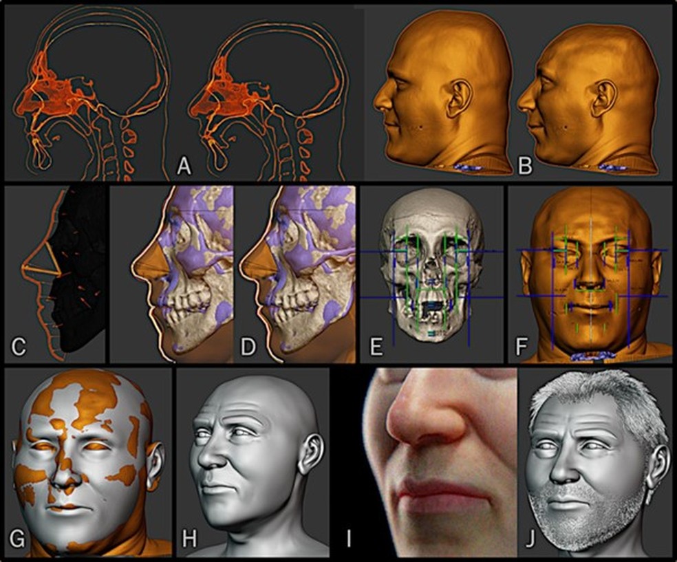 O designer explicou que foi desenvolvido uma metodologia de tripla medição, que combina três parâmetros: circunferência craniana, arco sagital e arco coronal. — Foto: Reprodução