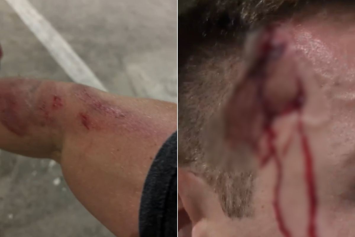 Guarda-vidas fica ferido após ser assaltado por ladrões de bicicleta no litoral de SP; VÍDEO 