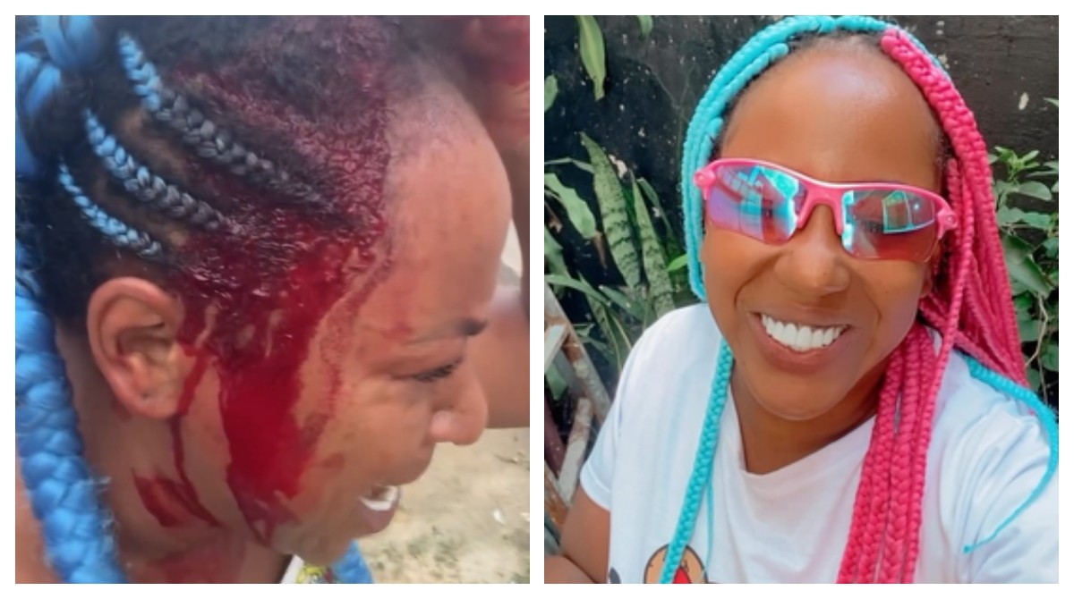 Cantora de funk diz ter sido agredida com pauladas pelo namorado MC em SP