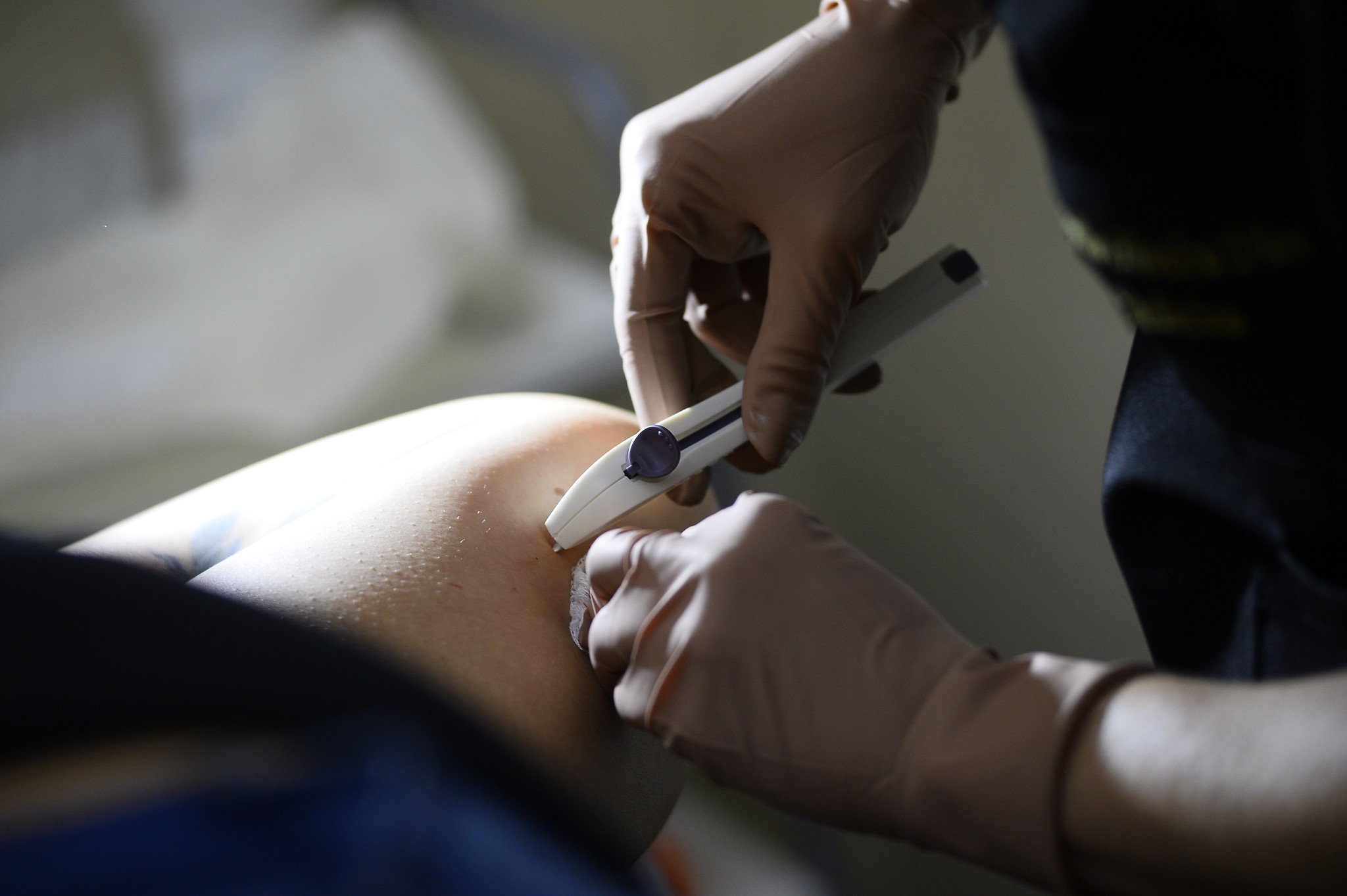 Novo método contraceptivo está disponível nas UBSs do DF; entenda 