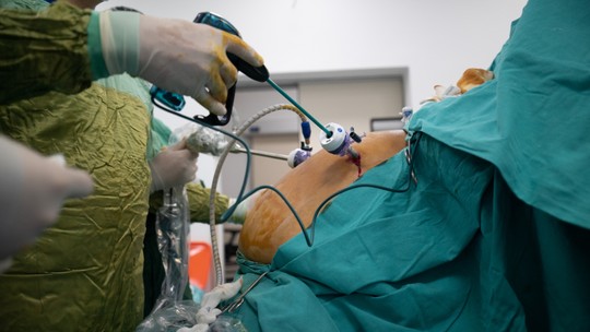 Fila da bariátrica: CFM amplia o público elegível, mas SUS realiza apenas 10% dos procedimentos - De 2020 a 2024, apenas 10% das cirurgias bariátricas foram feitas pelo SUS e as longas filas de espera na rede pública ainda tornam o procedimento uma realidade distante para quem mais precisa.