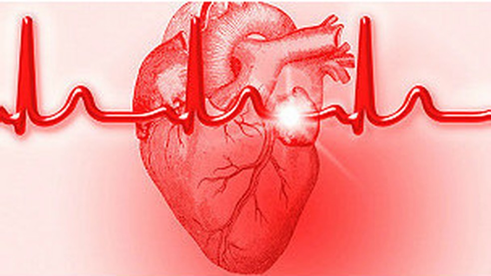 Infarto: os sintomas menos conhecidos de ataque cardíaco - BBC