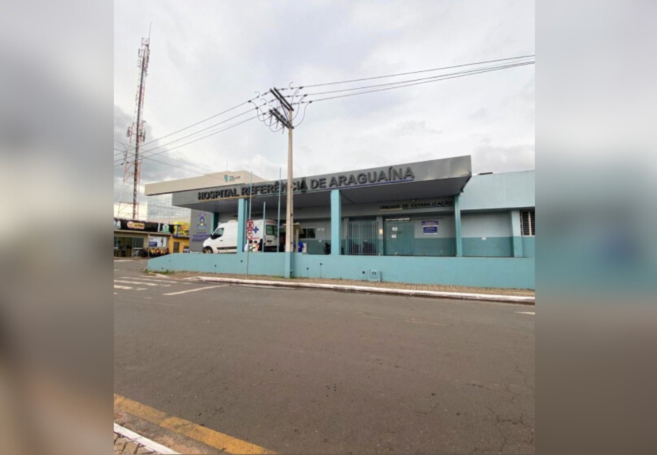 Mulher vai receber R$ 45 mil de indenização do Estado por passar 60 dias com osso exposto em hospital público