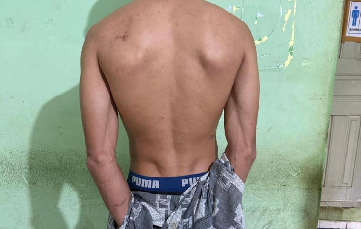 Homem é preso suspeito de tentar matar ex-companheira com 21 facadas em Colinas