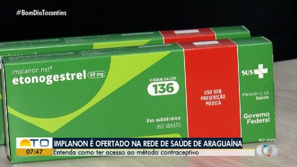 Saiba como ter acesso ao Implanon na rede de saúde de Araguaína