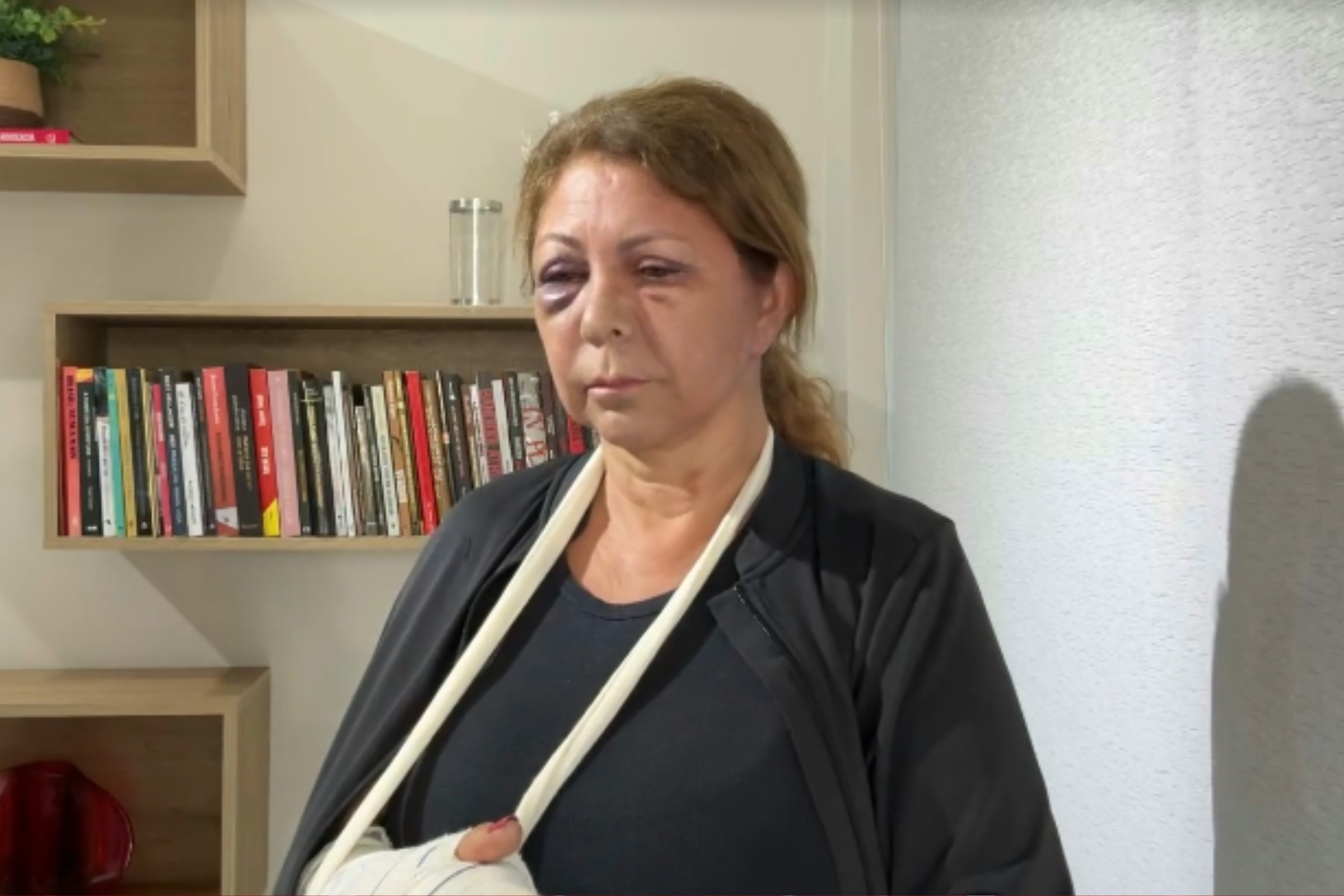 MP contrapõe polícia e denuncia hóspede por tentativa de feminicídio contra recepcionista, em Curitiba