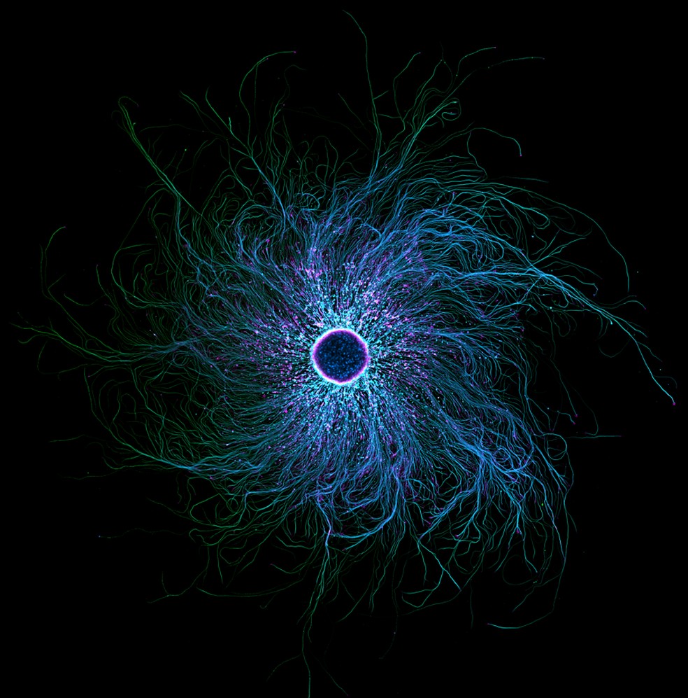 Neurônios sensoriais derivados de células-tronco marcados com tubulina e actina. A imagem da americana Stella Whittaker ficou em 7º lugar no Nikon Small World 2025. — Foto: Stella Whittaker / Nikon Small World 2025