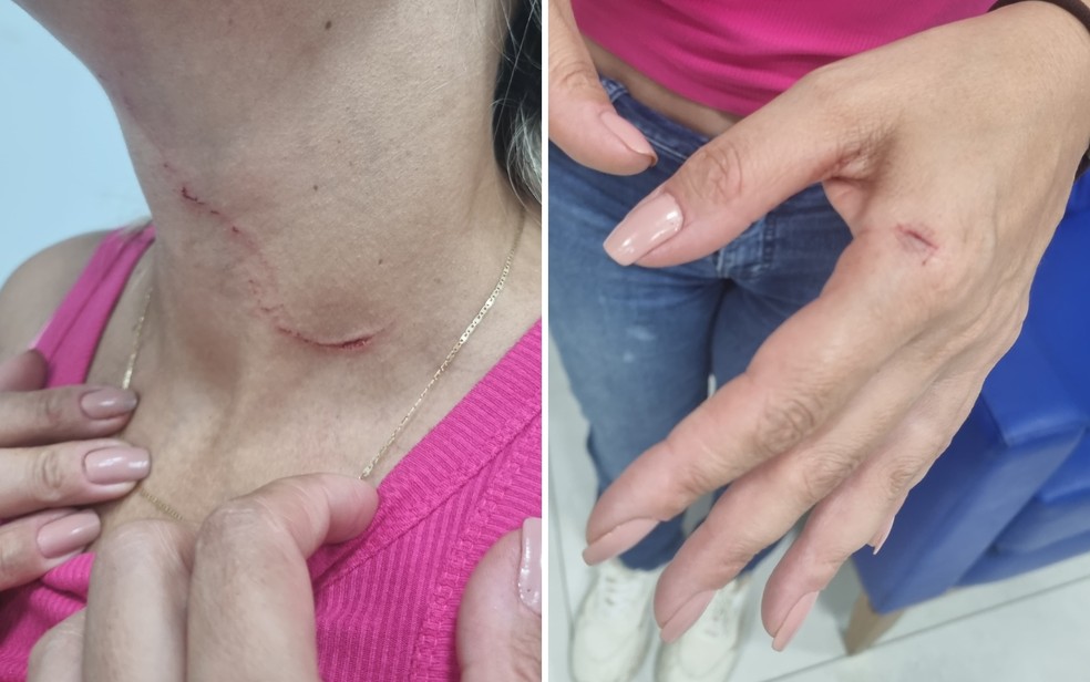 Motorista de aplicativo sofreu ferimentos no pescoço e na mão durante sequestro seguido de assalto, em Goiás — Foto: Divulgação/Polícia Militar de Goiás