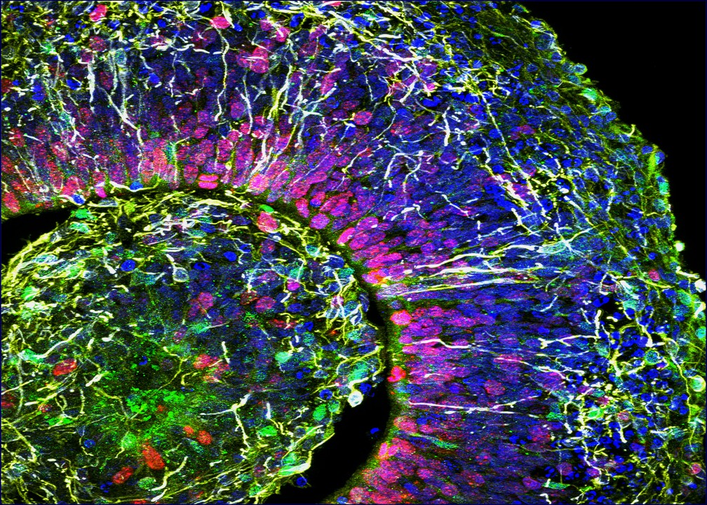 Micrografia de alta resolução mostra um pedaço de um minicérebro. Imagens do tipo ajudam os cientistas a entender em detalhes como funciona o processo de envelhecimento desses organoides. — Foto: Arquivo Pessoal/Alysson Muotri