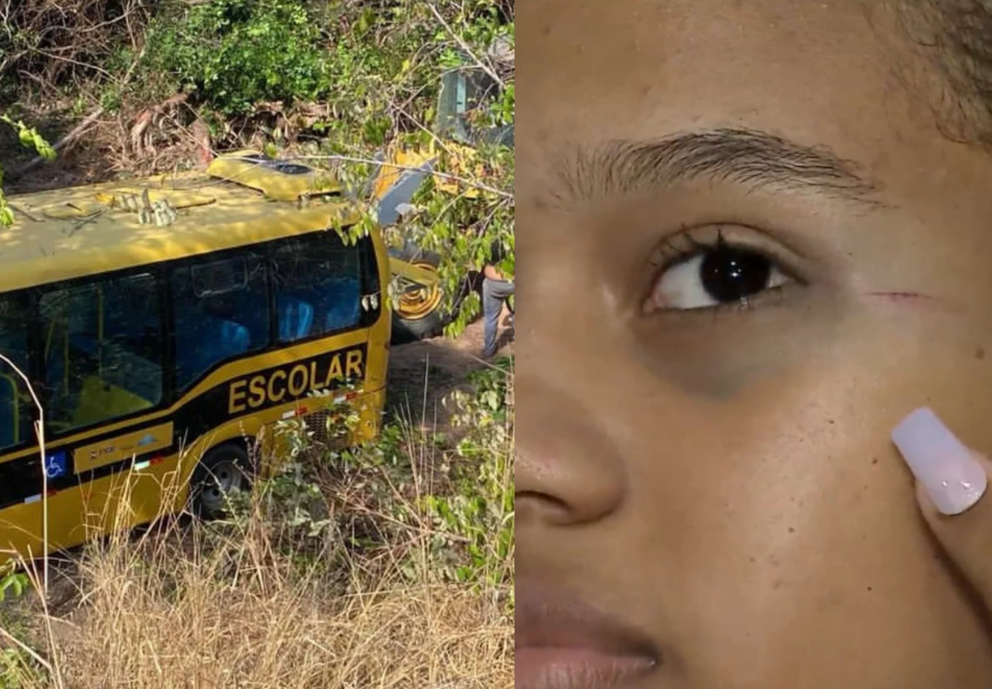 Famílias de alunos que sofreram acidente com micro-ônibus escolar em São José de Ribamar denunciam falta de assistência: ‘Nunca me procuraram’