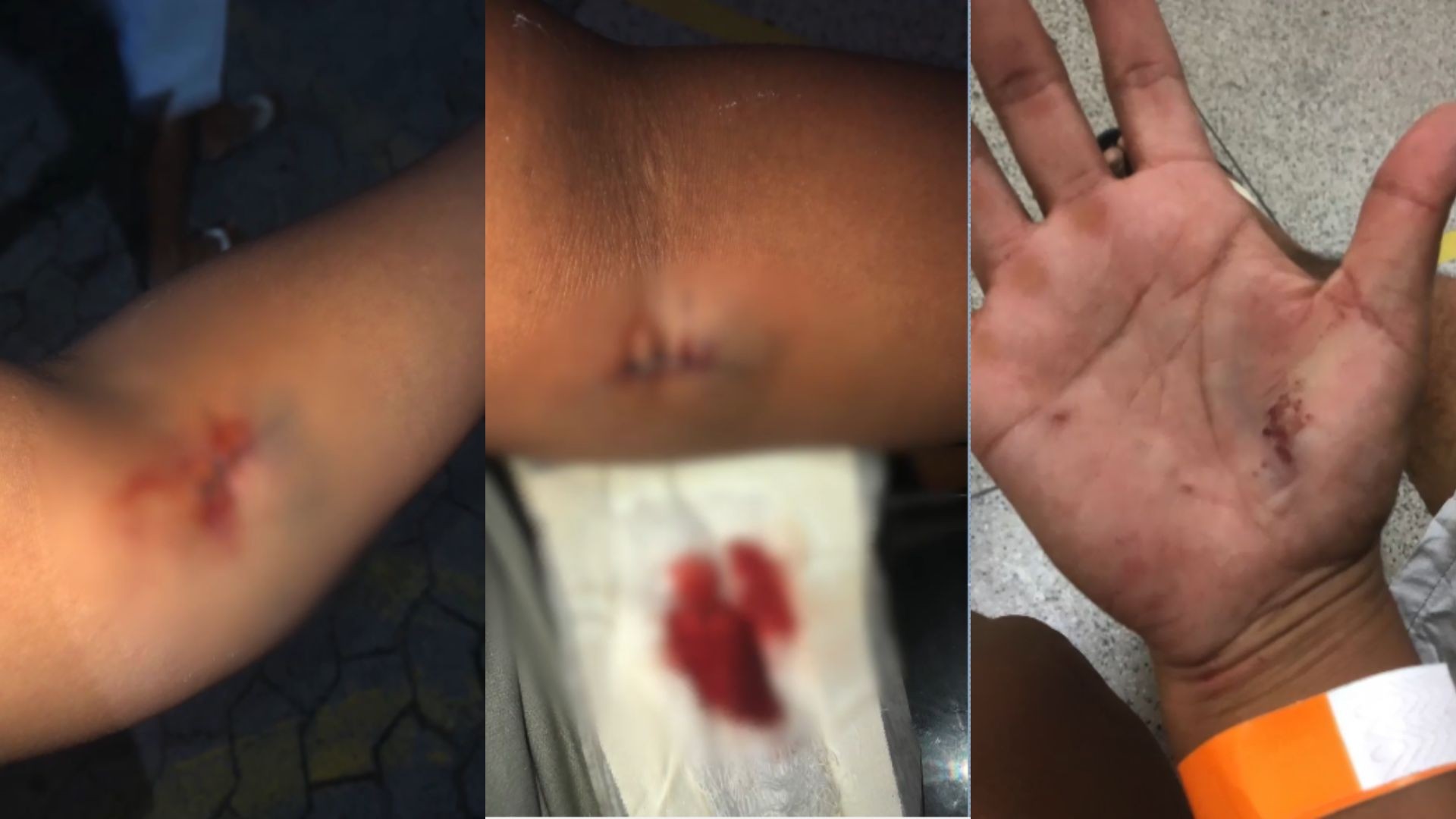 Mulher é esfaqueada pelo vizinho dentro da própria casa ao flagrar tentativa de furto, na Serra