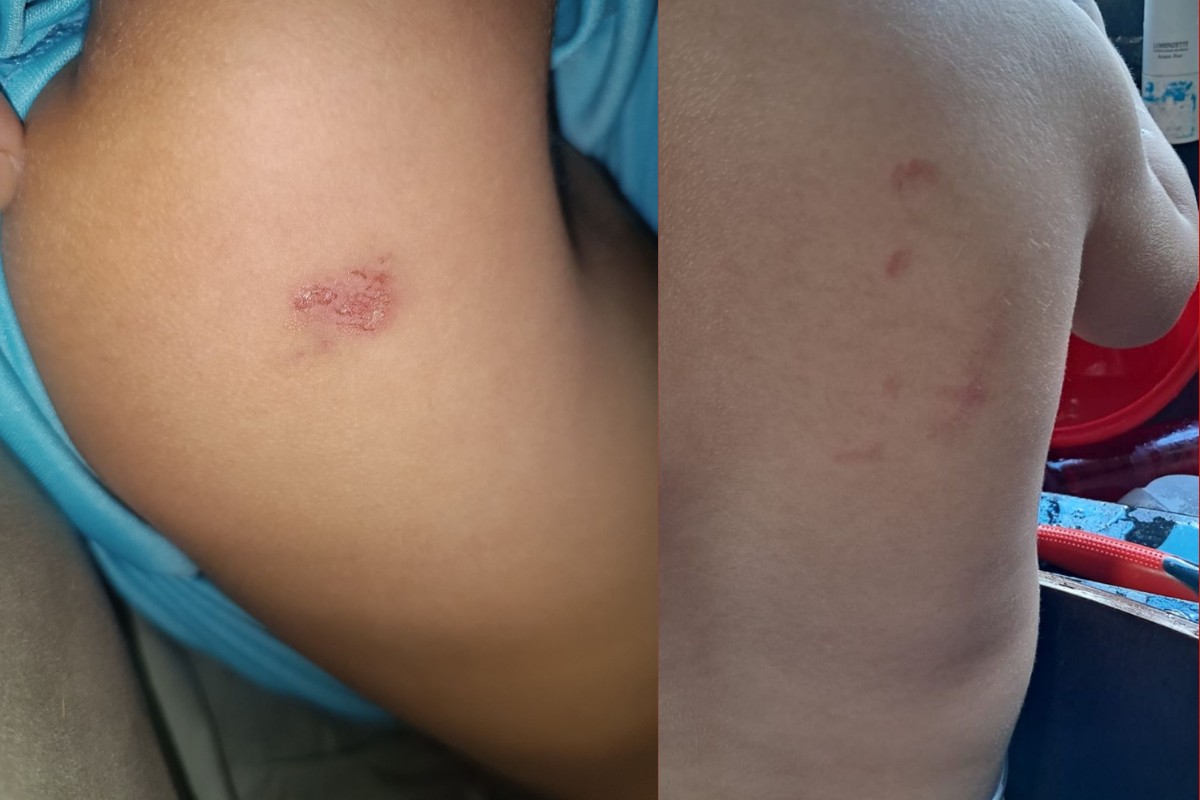 Professora é afastada após mãe colocar gravador na mochila do filho e outra denunciar maus-tratos em MT 