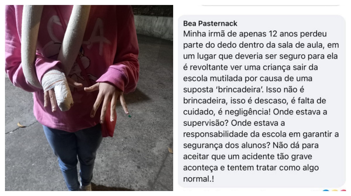 'Sucessão de erros e negligência impediram reimplantação do dedo', diz irmã de estudante ferida em escola de SP