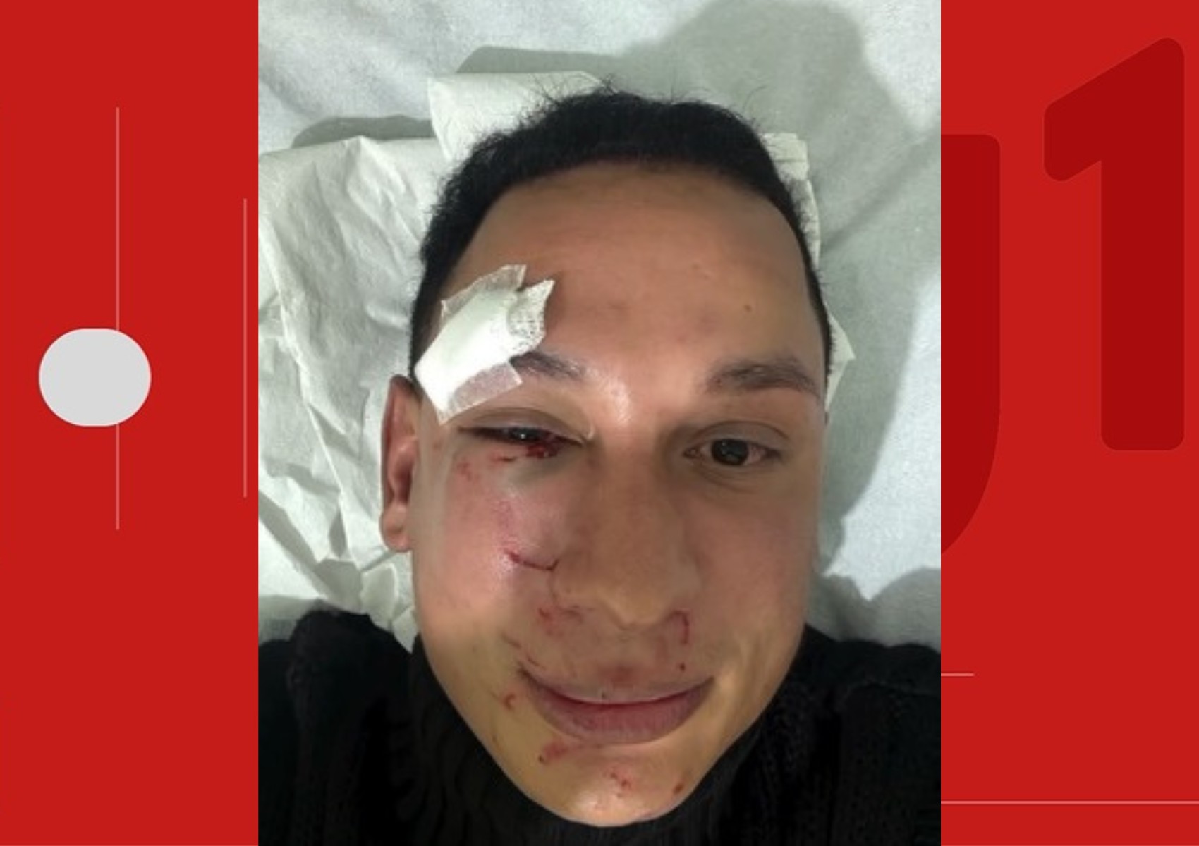 Cirurgião-dentista denuncia ter sido agredido por dois homens em camarote privado de São João na Bahia: 'trauma físico e psicológico'