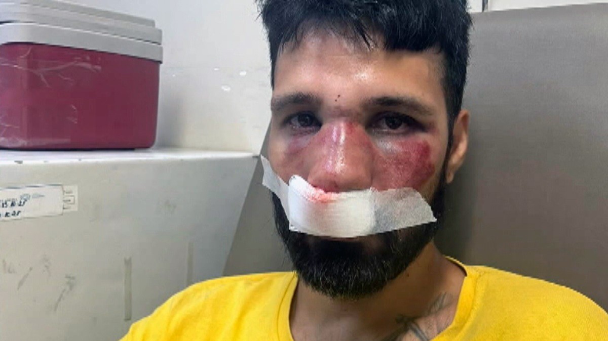 DJ denuncia ter sido agredido por entregadores ao ser confundido com ladrão