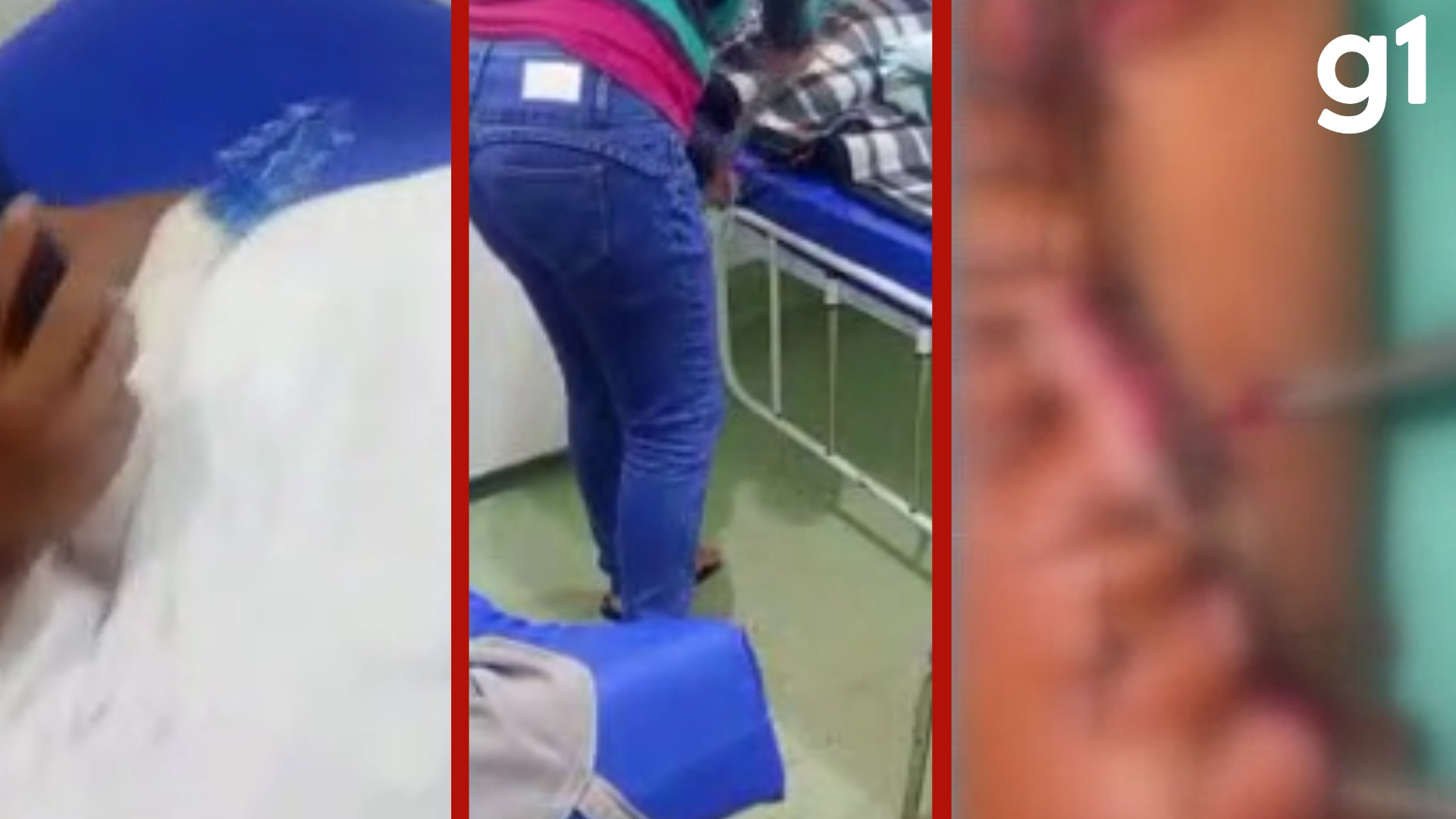 Adolescente internado encontra larvas em curativo no Pronto-Socorro de Várzea Grande (MT)