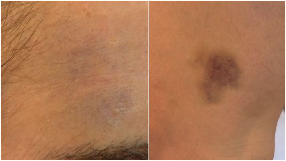 Em um mês, mais de 500 suspeitos de violência contra a mulher são presos no Ceará. — Foto: Reprodução