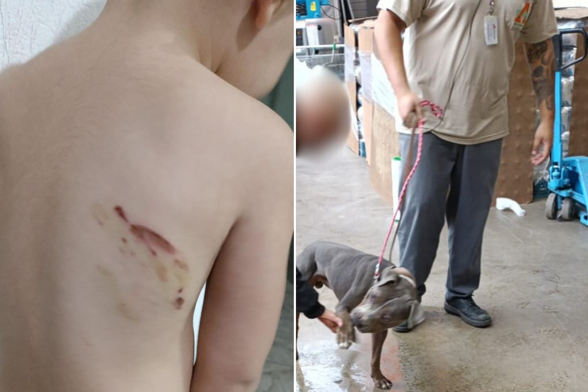 Mãe de criança de dois anos atacada por pitbull em supermercado relembra 'momentos de terror' 