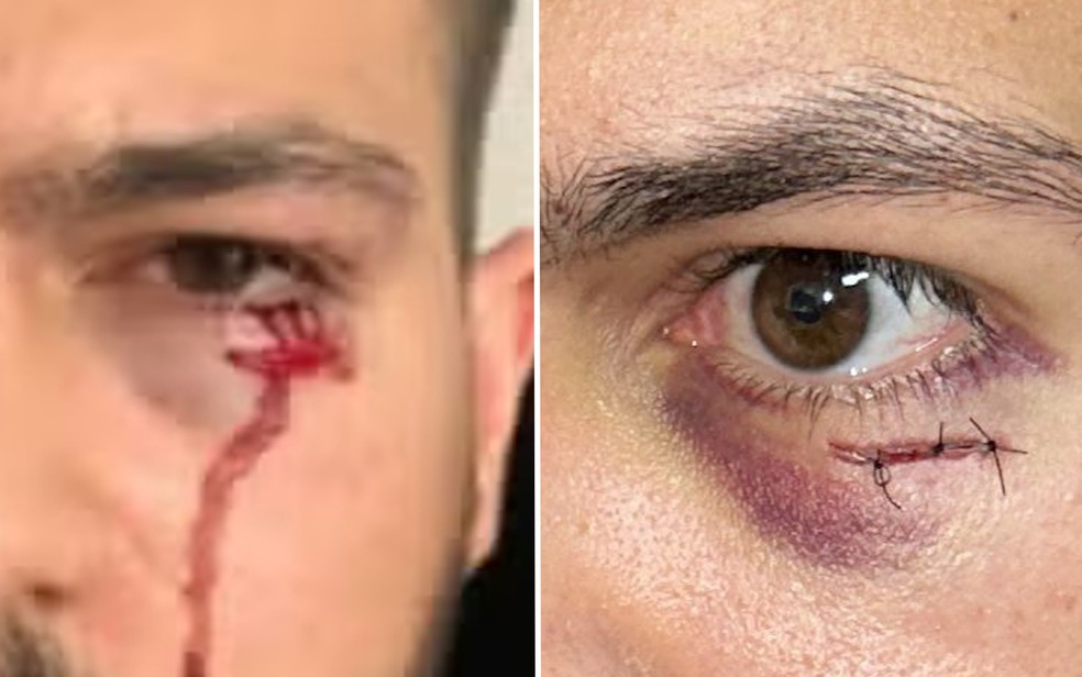 Médico é agredido por marido de paciente que morreu durante atendimento em UPA de Águas Lindas de Goiás — Foto: Reprodução/PM/Pablo Henrique/Arquivo Pessoal